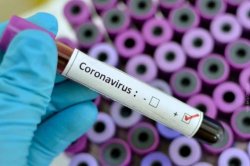 Suman 26 positivos de coronavirus en Corrientes
